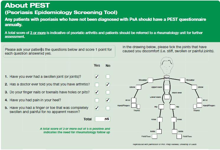 Psoriasis Epidemiology Screening Tool (PEST) All Outside In materials can be