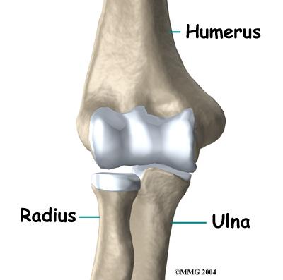 But there is a second joint where the end of the radius (the radial head) meets the humerus. Introduction Nursemaid's elbow is a common injury in young children.