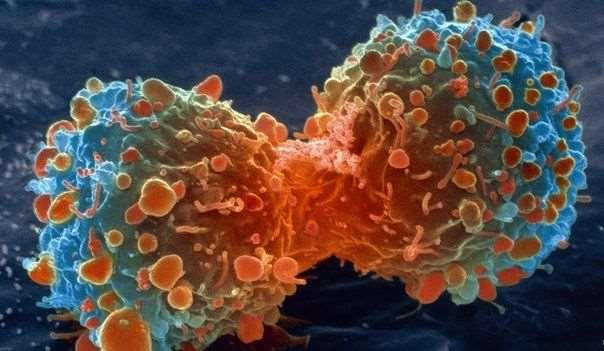 So what is lymphoma?