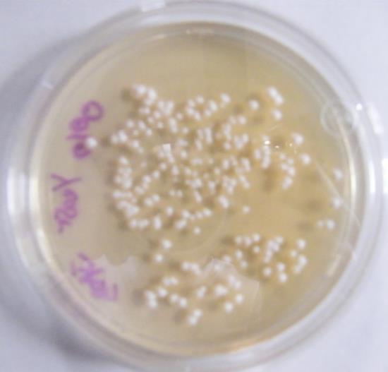 coli The human micro flora