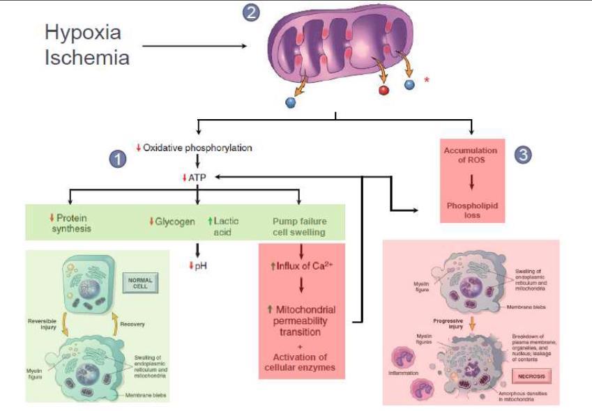 C Accumulation of reactive oxygen species (ROS) Ischemia injures tissue faster than hypoxia. Cellular Function will be lost long before cell death occurs (e.g., myocardial cells become noncontractile after 1 to 2 minutes of ischemia, but may not die until 30 minutes of ischemia elapsed.