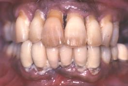 THE CLINICAL EXAMINATION Extra-oral Examination Neck Palpation Nodes Peri-oral tissues Lips Intra-oral Examination