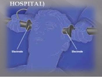 ELECTROCONVULSIVE THERAPY ELECTRICALLY INDUCED SEIZURE IMPACTS THE ENTIRE