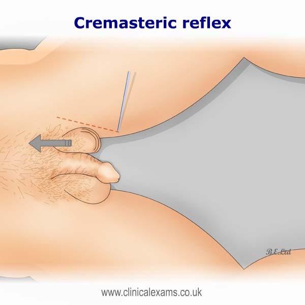 stroking the abdomen Cremasteric reflex (useful in