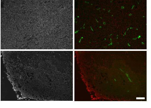 Intratumoral IFN- exerts a profound anti-angiogenic effect Dark field Tumor cells
