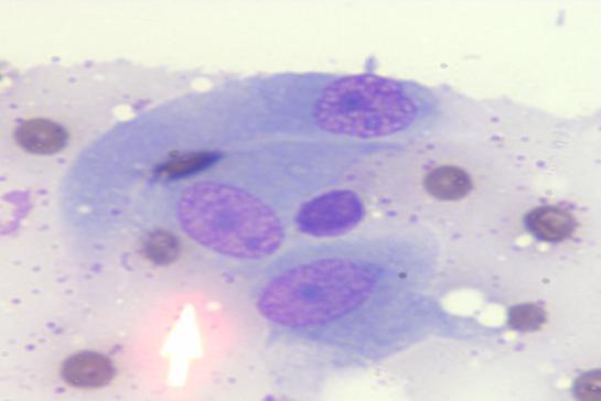 In general, cells are large and round with distinct, intact cytoplasmic borders and the nuclei tend to be round to oval in shape.