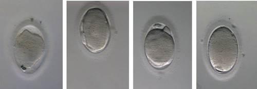 concerns of embryo cryopreservation Solving