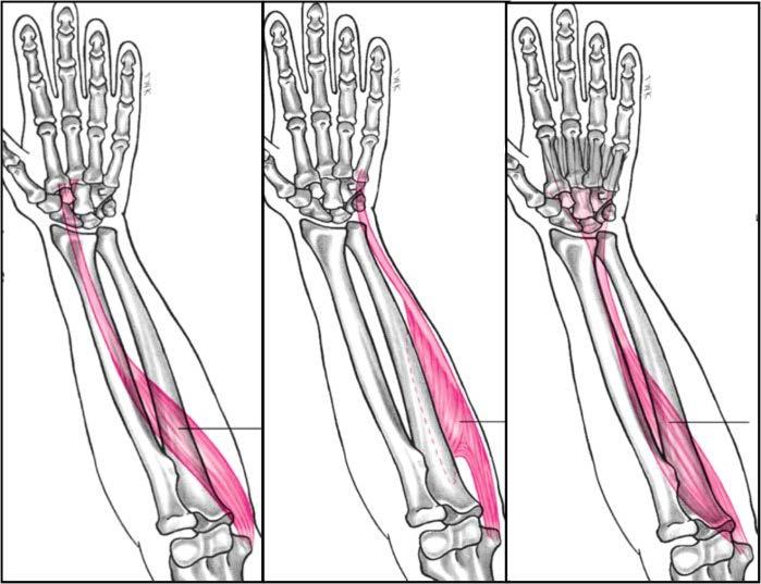 Muscles Wrist Flexion Agonists Flexor carpi radialis Flexor carpi ulnaris Palmaris longus Flexor digitorum superficialis