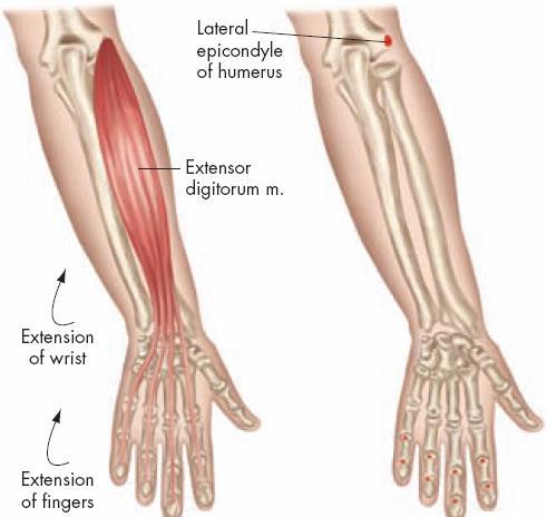 Individual Muscles of the Wrist and