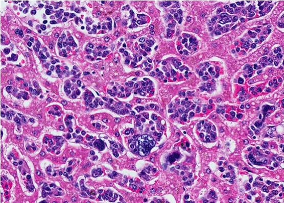 Figure 5 Histologic section of liver stained with H+E from the Aperio digitalized histologic section.