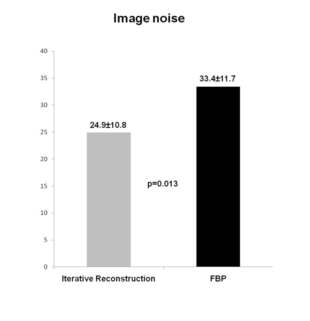 Fig. 1: Image noise comparison between iterative image reconstruction and Filtered Back projection (FBP).