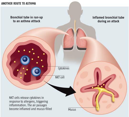 Asthma Deaths are Usually Preventable Literature indicates 3 major causes of asthma death: Delay in seeking or receiving appropriate care Medication misuse; poor adherence - under-use of