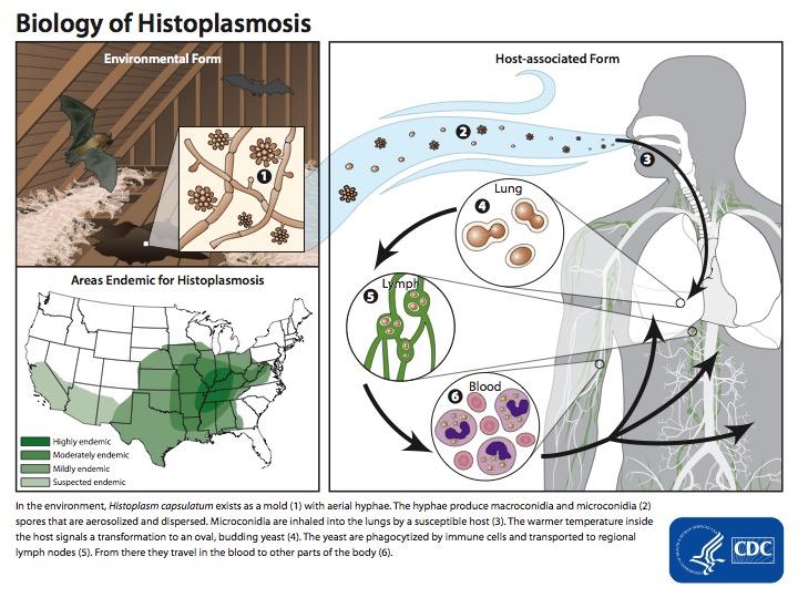 Disseminated Histoplasmosis Most immunocompetent individuals are asymptomatic < 0.