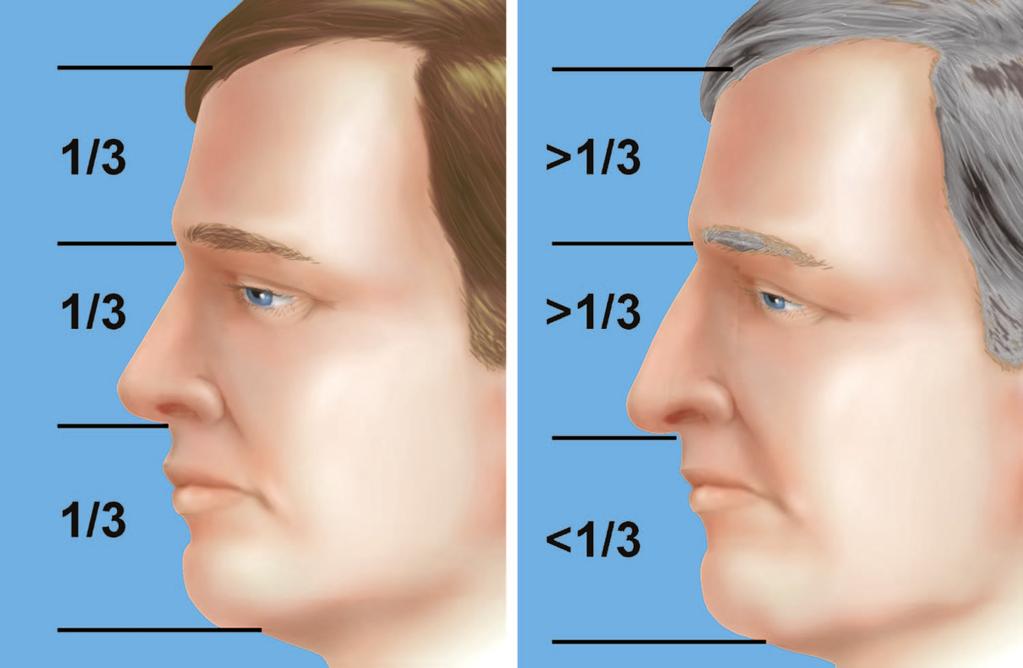 Vol. 114, No. 7 / RHINOPLASTY WITH ADVANCING AGE 1937 FIG. 1. Changes in aesthetic facial proportions with age. FIG. 2. Changes in nasal characteristics with age.