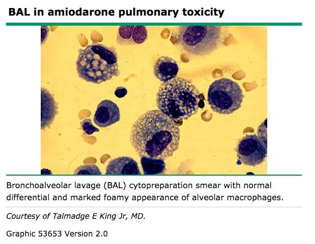 Pulmonary toxicity Occurs with higher cumulative doses - slow onset (weeks - years) Manifests
