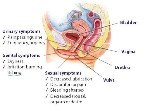 Embryonic Development: Urogenital sinus Mullerian duct = uterus and
