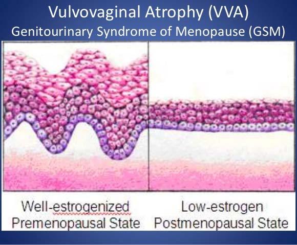 Vaginal vestibule, and lower 1/5 of the vagina, urinary bladder,