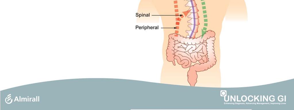 Patients with IBS may have visceral hypersensitivity (enhanced perception of gut stimuli) and abnormal patterns of endogenous pain modulation: 1 Supraspinal: cognitive, emotional, and autonomic