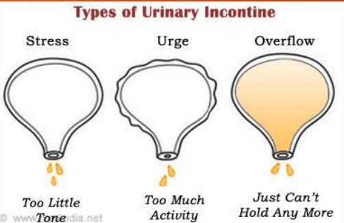 URINARY DYSFUNCTION