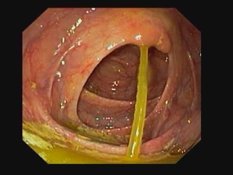 It flows from the liver into the gallbladder where the bile is stored.