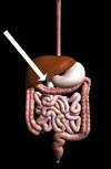 Duodenum Food travels from the stomach and enters the duodenum where is it digested further.