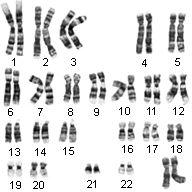Karyotype a picture of your chromosomes Chromosomes