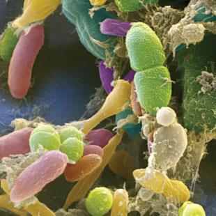 MICROBIAL STOWAWAYS: Bacteria of the human gut microbiome are intimately involved in cancer development and progression, thanks to their interactions with the immune system.