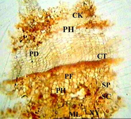Microscopy: Transverse section of the bark shows presence of cork, phellogen, phelloderm, sclerenchymatous tissue and secondary phloem (Fig. 1).