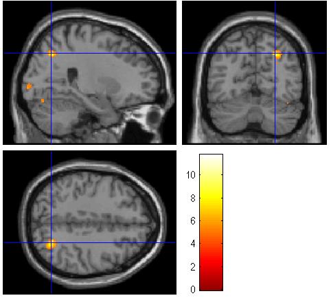 Charitable bequest decision making emphasizes visualized autobiography brain regions MNI co-ord inates Peak p FWE Contrast Brain Region (1) Beq> Give