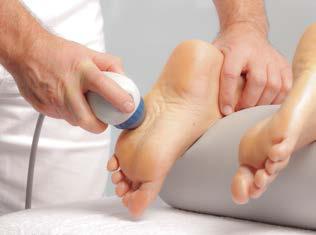 FOOT PAIN ASSOCIATED WITH METATARSALGIA Step 1: R-SW Pulses/session 3000 R15 DI15 Step 2: R-SW Pulses/session 3000 D20-S Step 3: V-ACTOR