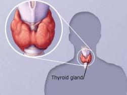 Thyroid A butterfly-shaped gland at the base of the neck in front of the throat It has two lobes, one on either side of the windpipe, connected by the isthmus Makes the hormone