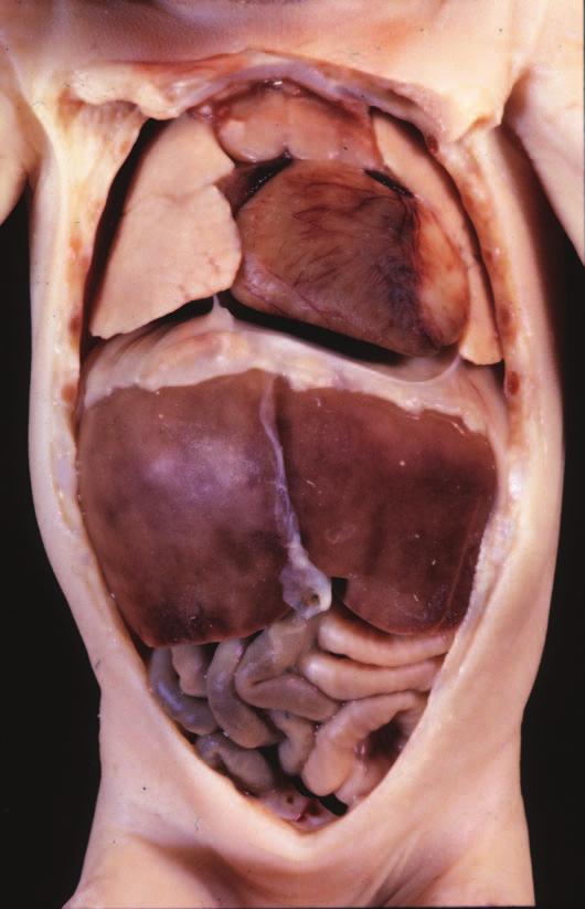 RL Liver Thymus RV Fig. 1.11. This fetus is viewed from the front following removal of the anterior chest and abdominal walls to show the heart lying in the left chest with its apex pointing leftward.
