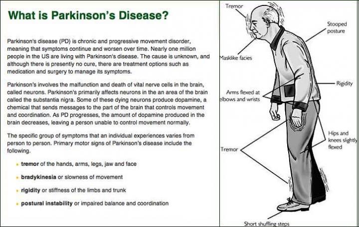MOTOR FEATURES OF PARKINSON S DISEASE T Tremor R