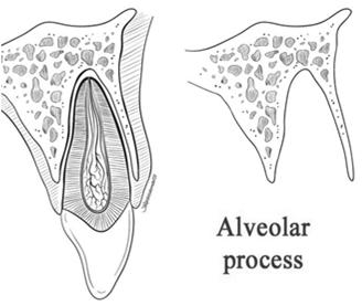 keep alive for avulsed tooth Slide 17 Alveolar Process
