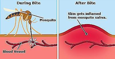 1) Ectoparasites Ectoparasites live on the surface of the host such as (mites, ticks, lice, mosquitoes).