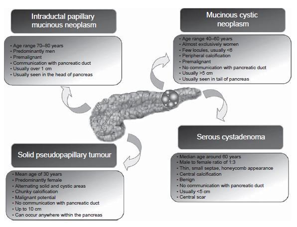 Features of common pancreatic cysts Branches type Macrocystic with microcystic varients Microcystic with macrocystic varients Garcea G, Ong SL, Rajesh A, et al.