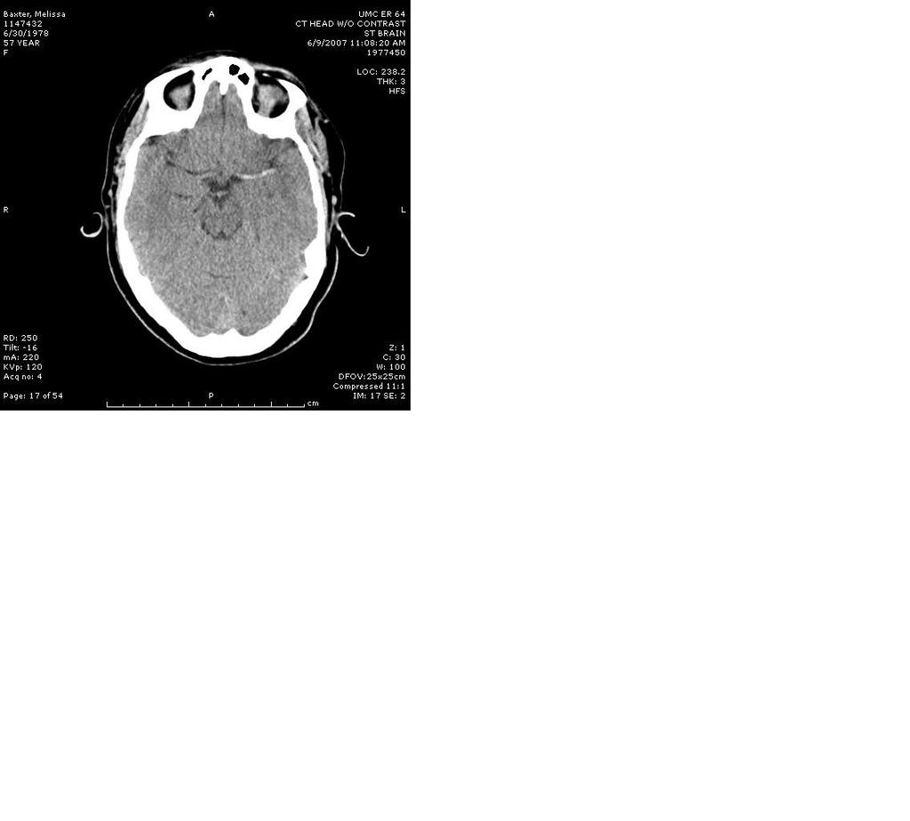 Initial CT Brain