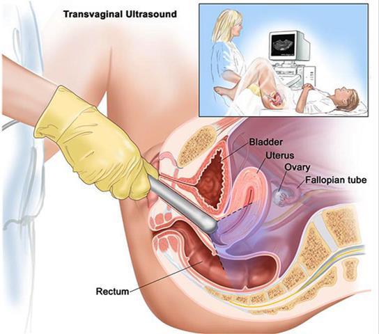Gynecology The female pelvis is routinely evaluated by ultrasound This intimate exam is performed vaginally