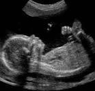 Obstetrics Sonographers are responsible for imaging