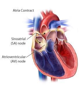Atria Contract Each contraction begins in a small group of cardiac muscle fibers the sinoatrial node (SA node) located in the right atrium.