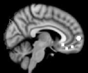 Control of emotion, memory and motivation Attending to external environment Middle frontal gyrus
