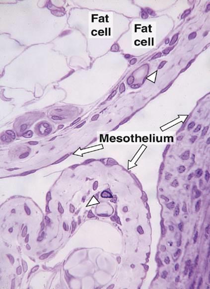 Mesothelium is the simple squamous epithelium that lines serous cavities