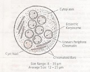2 Cyst stage : The typical characteristics of this stage are : It is round to spherical in shape, surrounded by thick cell wall The cytoplasm contain ( 1 8 ) nuclei.