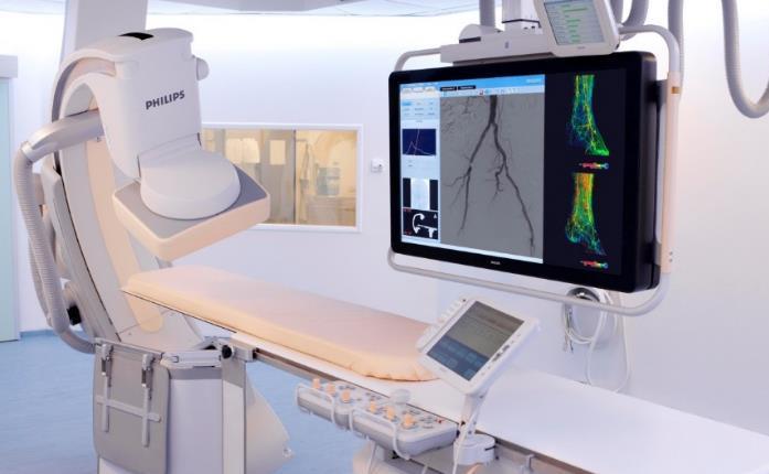 Informed Therapy Guidance interventional oncology All in one room solutions OncoSuite OncoSuite Liver tumor embolization XperCT Dual: 1st DualPhase C-arm for Oncologic Imaging.