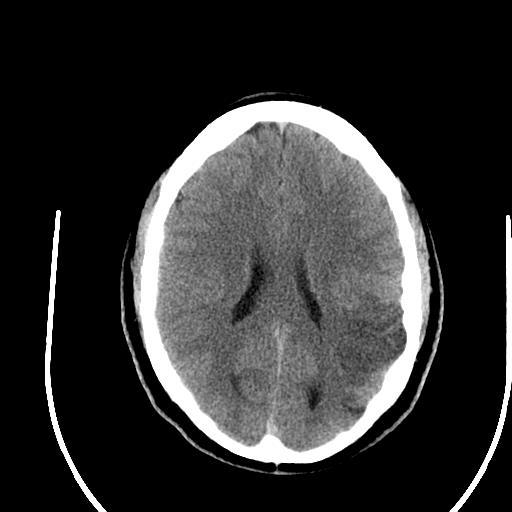27-year-old male Expressive aphasia