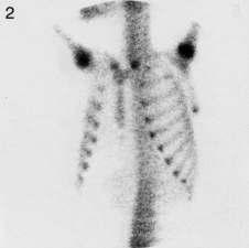 view of thorax Fig. 2.