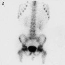 6: Age 3 4 Years Spine, Pelvis and Femora Fig. 1.