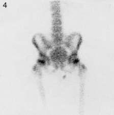 Anterior view of spine pelvis and femora Fig. 2.