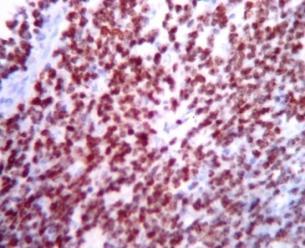 with small nucleoli. (H &E stain, x400).