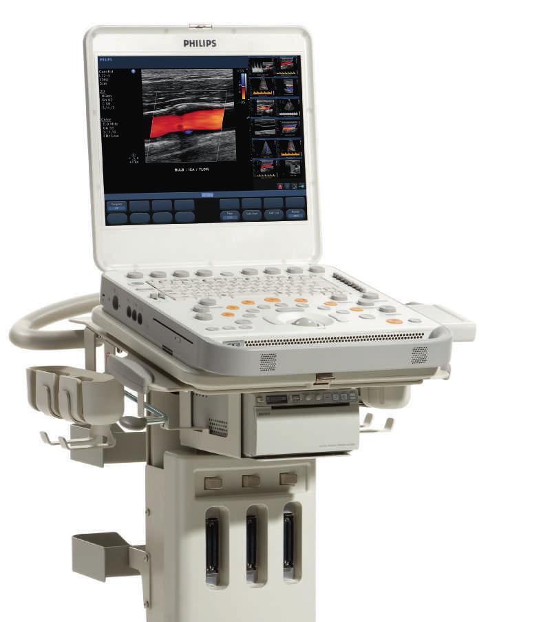 Philips CX30 CompactXtreme Philips CX30 CompactXteme ultrasound system goes wherever you need it, bringing ultrasound excellence to the bedside and beyond.